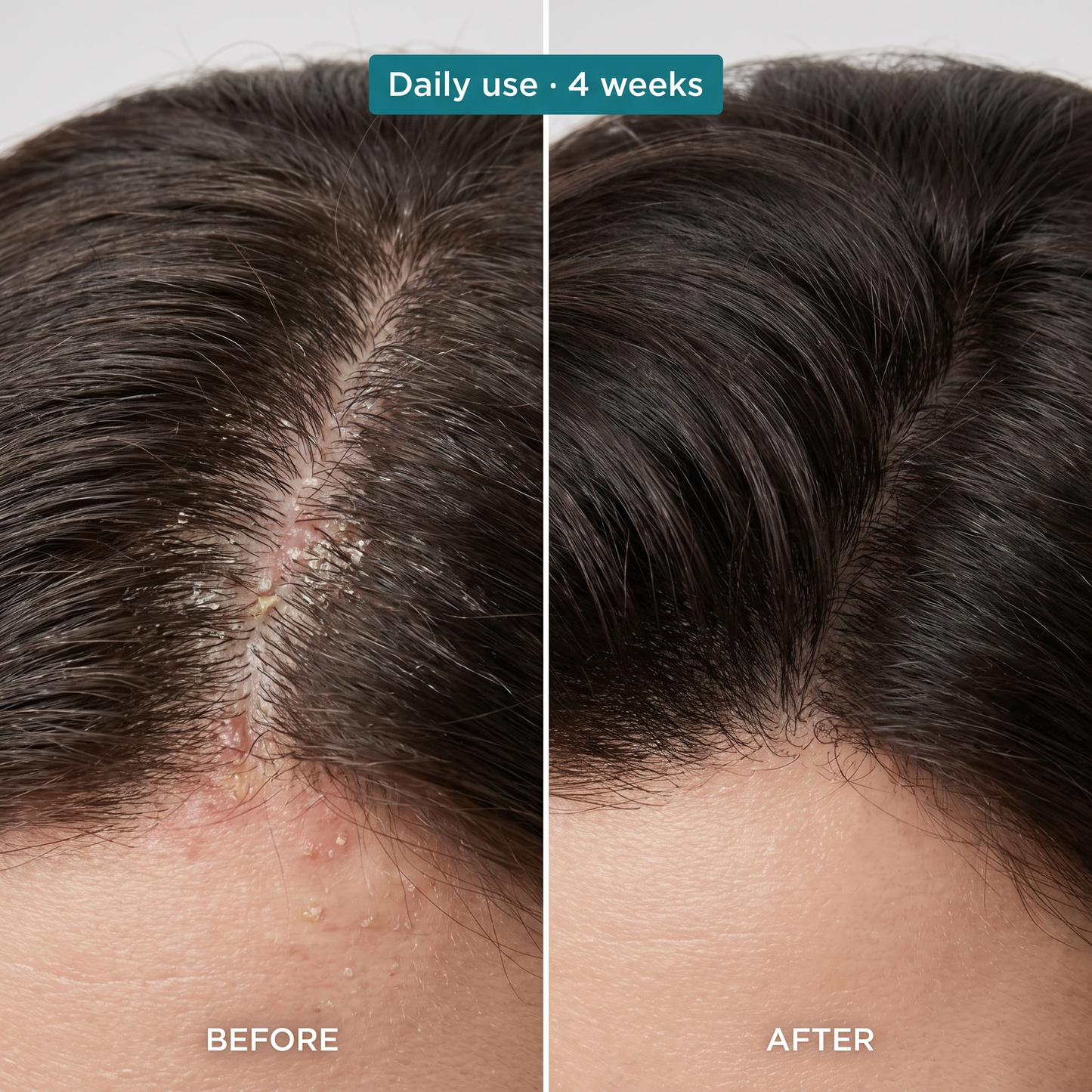 Lunora PDRN Scalp Renewal Serum