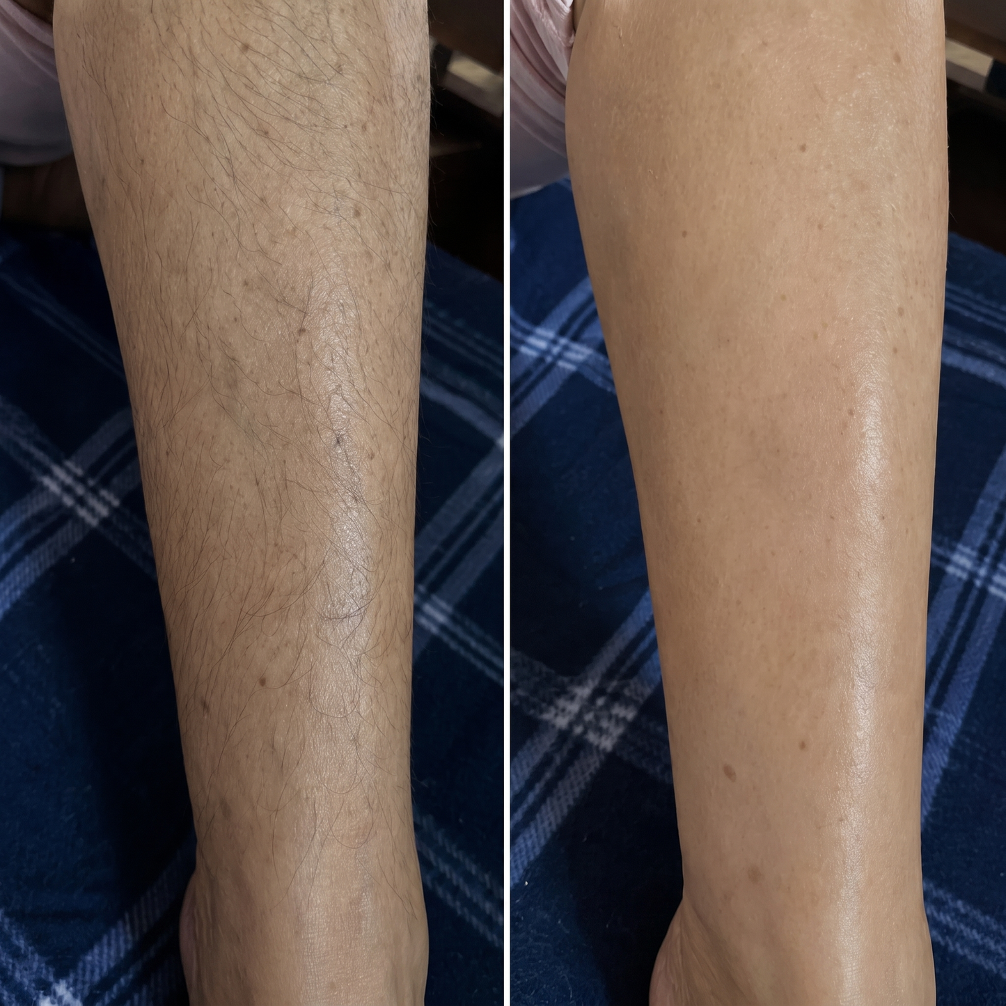 Lunora Steady™ Hair Removal Cream