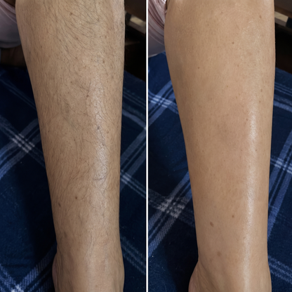Lunora Steady™ Hair Removal Cream